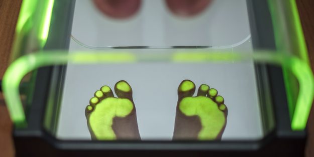 Revisión de los pies